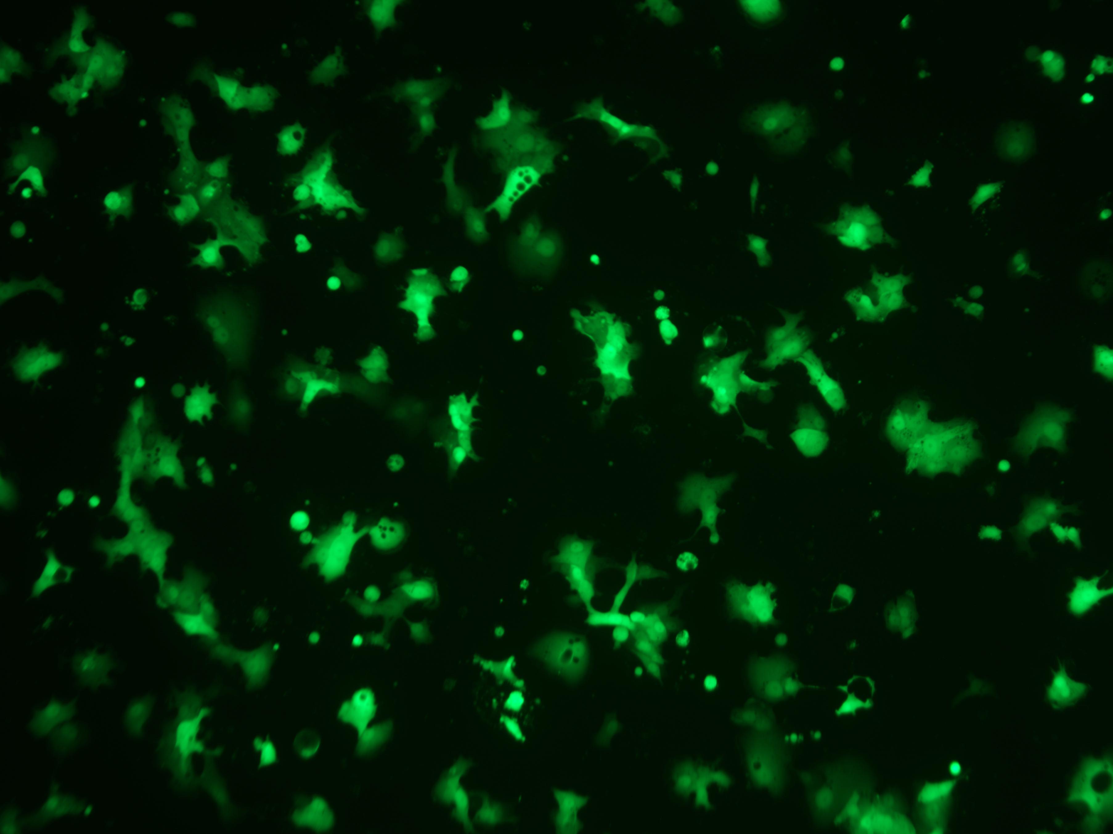 案例分享：人前列腺癌細胞熒光動態長時程成像監測